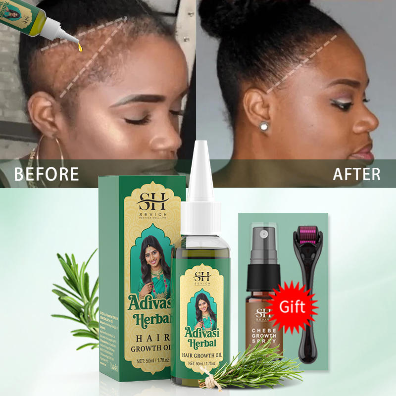 Ayurvedic Hair Growth Oil Indi - Ingrown Hair Serum ulasan dan harga
