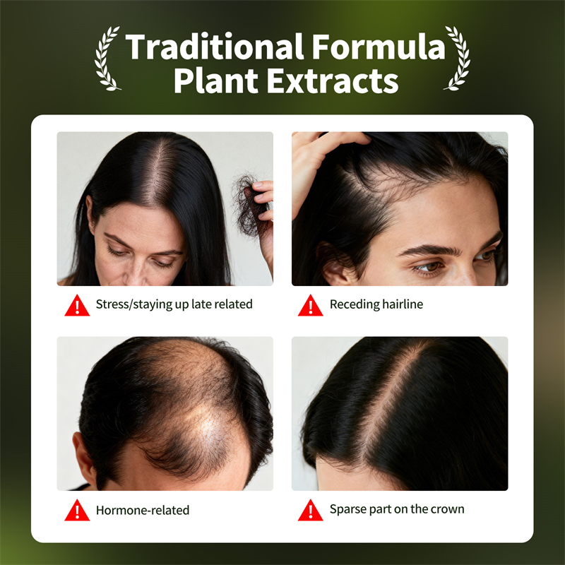 Natural Hair Growth Set Usman  - Ingrown Hair Serum ulasan dan harga