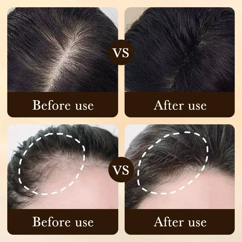 Biotin Fast Hair Growth Oil Pr - Ingrown Hair Serum ulasan dan harga