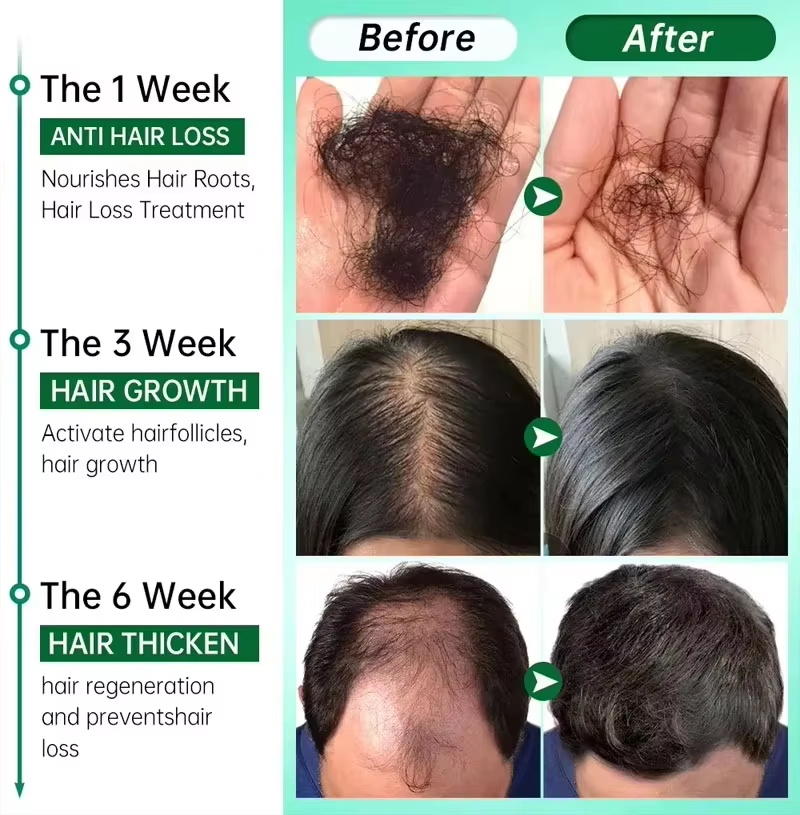 Hair Growth Serum 7 Days Fast  - Ingrown Hair Serum ulasan dan harga