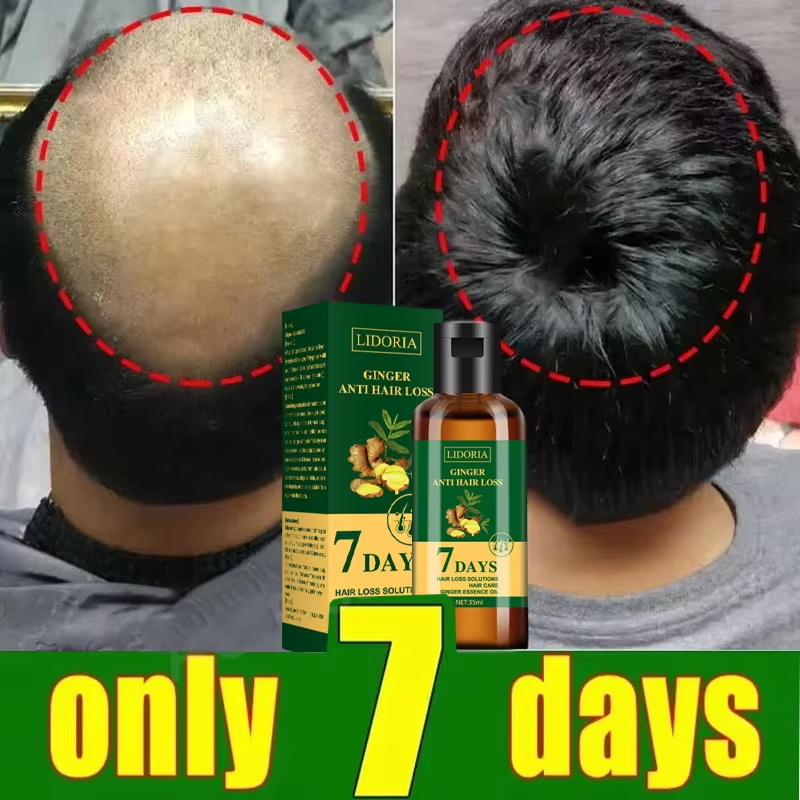 Hair Growth Serum 7 Days Fast  - Ingrown Hair Serum ulasan dan harga