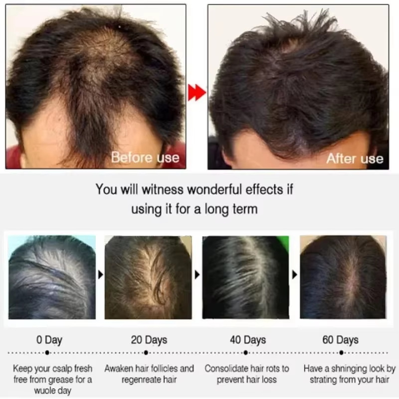 Hair Growth Serum 7 Days Fast  - Ingrown Hair Serum ulasan dan harga