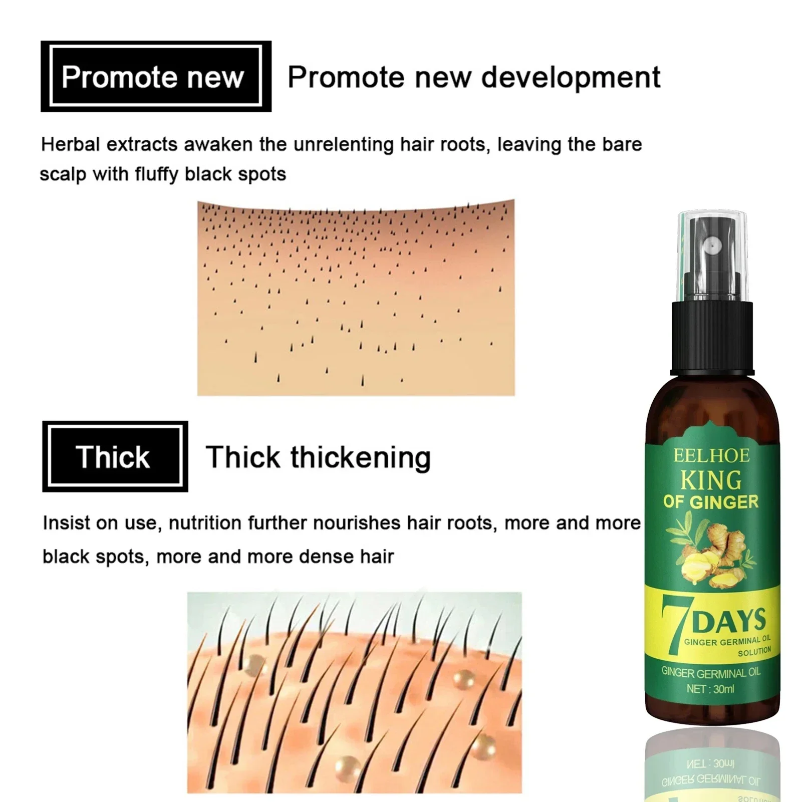 2024 Ginger Hair Growth Serum  - Ingrown Hair Serum ulasan dan harga