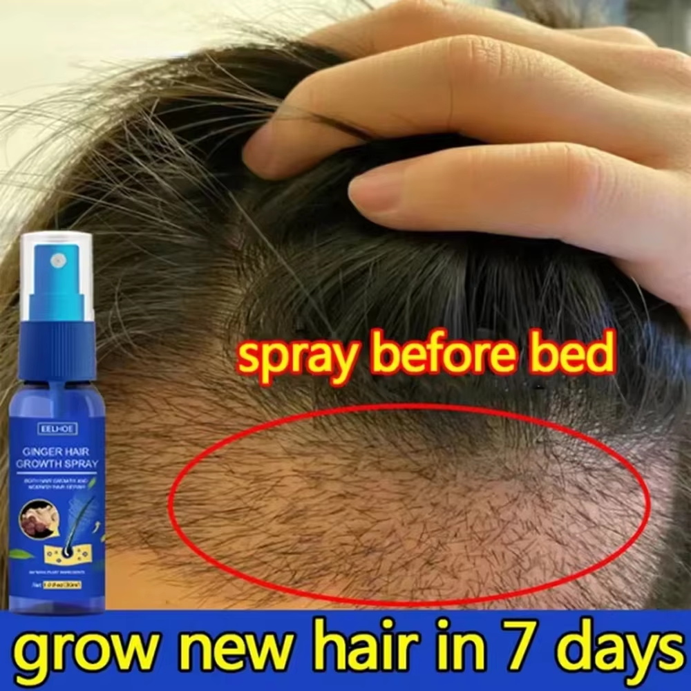 Fast Ginger Hair Growth Spray  - Ingrown Hair Serum ulasan dan harga