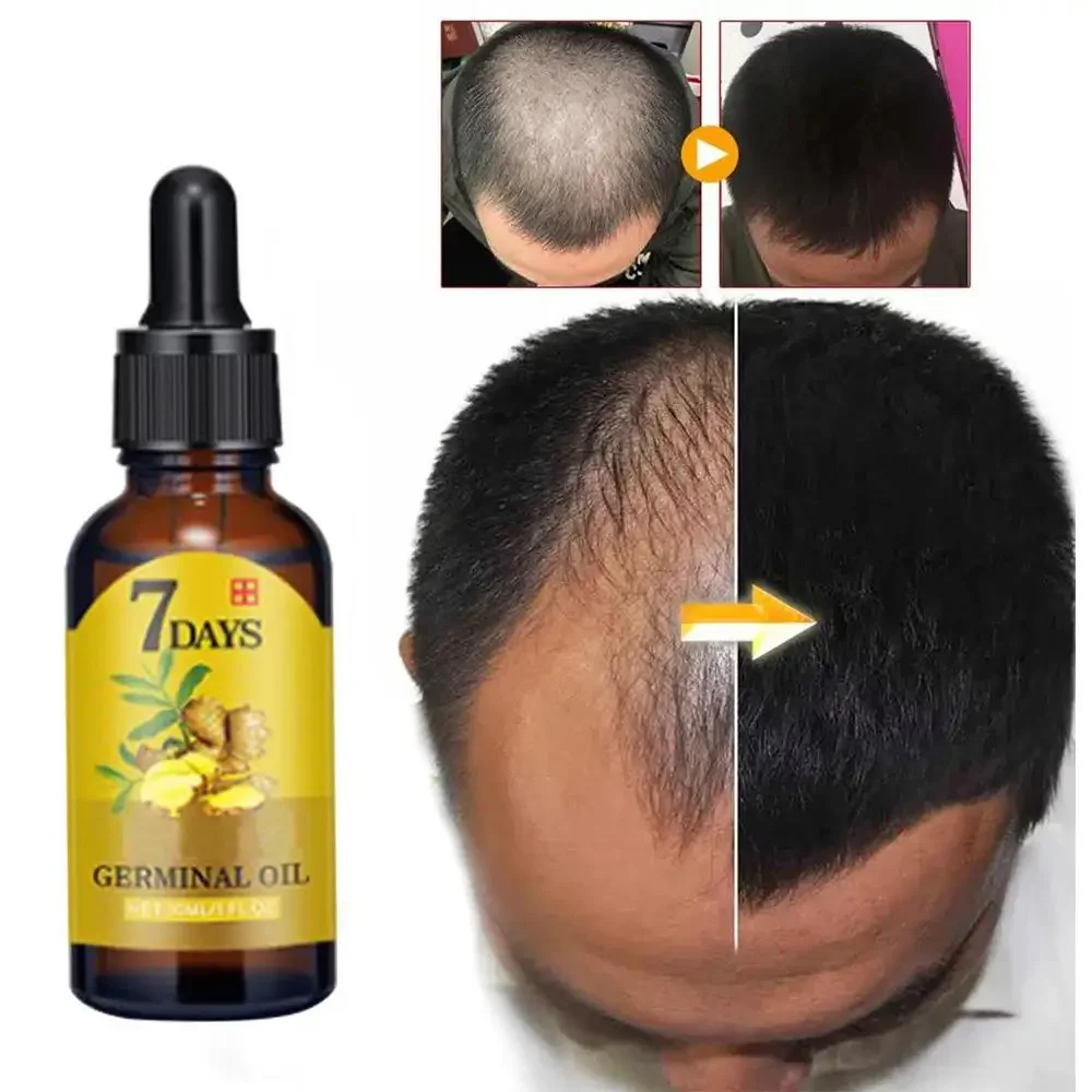 Hair Growth Ginger Fast Growin - Ingrown Hair Serum ulasan dan harga