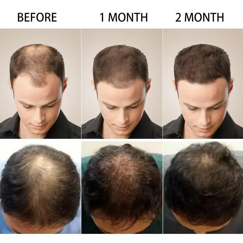 Hair Growth Ginger Fast Growin - Ingrown Hair Serum ulasan dan harga